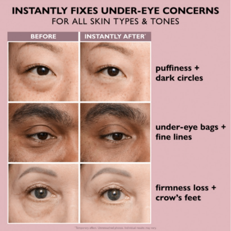 Instant action: smooths lines, reduces puffiness & dark circles.